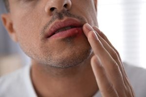 HSV News: Emerging Treatments You Can Try